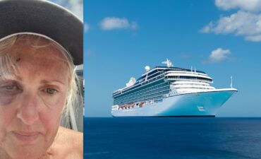 Kathryn's injuries after falling on her cruise.